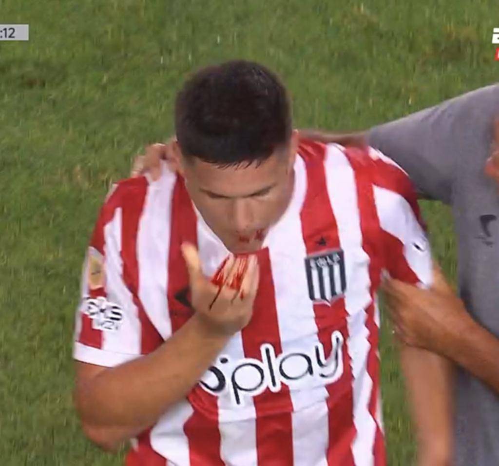 Carrillo más complicado tras perder tres dientes
