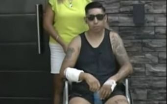 Dramático relato del joven de La Plata atacado por dos pitbull: "Me defendí a piñas y patadas"