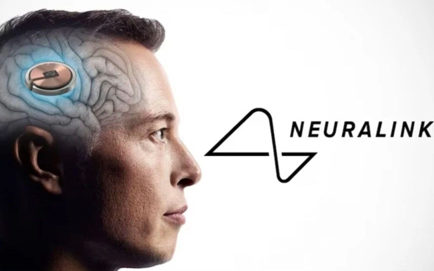 Neuralink: el primer paciente con chip cerebral ya puede controlar el mouse con la mente, dijo Elon Musk