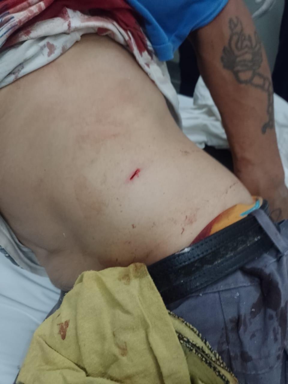 Los detalles del caso del hombre apuñalado por “su hijo no reconocido”