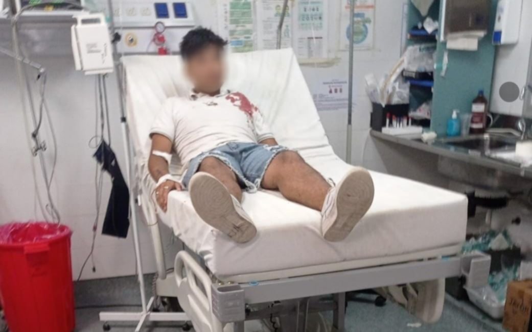 Como en una novela, pero en Berisso: le disparó en pecho a su cuñado