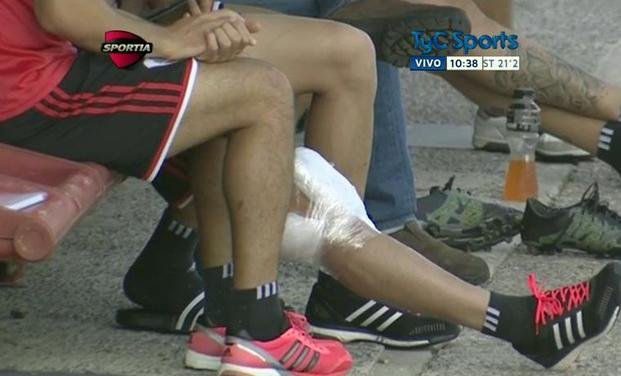 Alario se golpeó y generó alarma