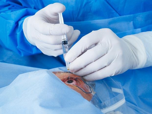 Le implantaron una córnea de cerdo y recuperó la visión