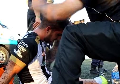 Jugadores de Cipolleti, con heridas tras ser atacados por hinchas