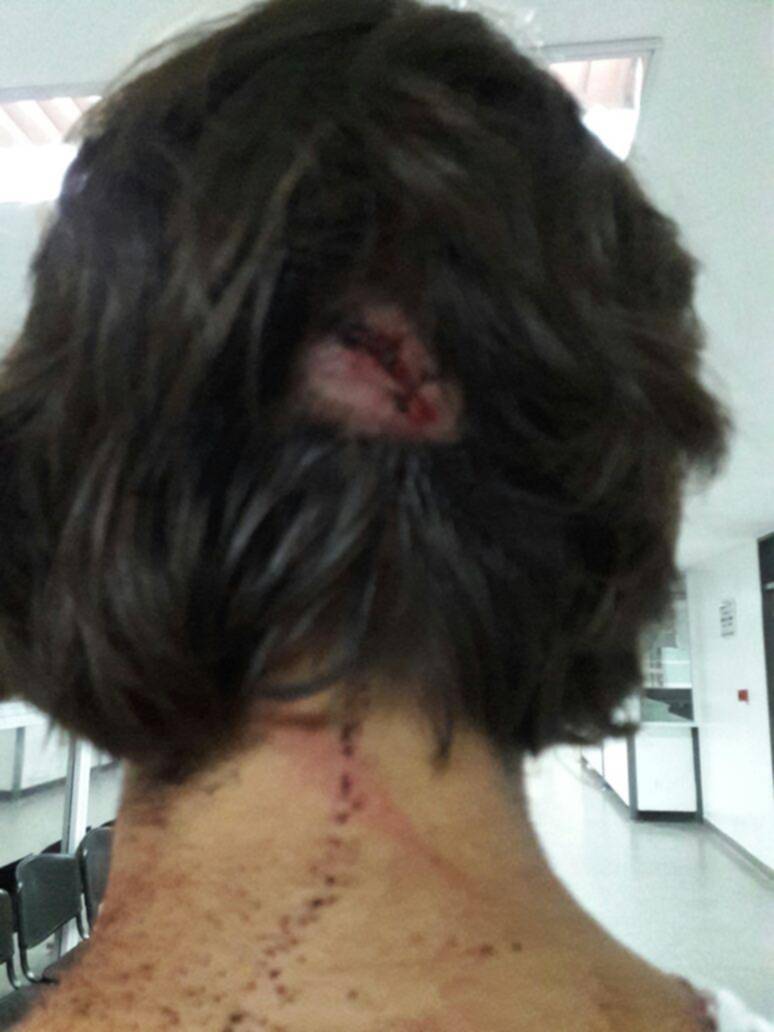Denuncian salvaje agresión de una patota