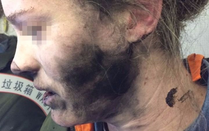 Alerta por auriculares explosivos en pleno vuelo 
