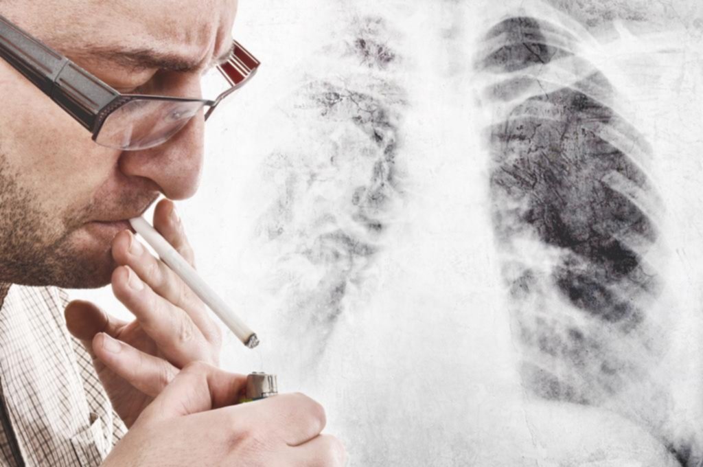 El cáncer de pulmón es el que más muertes causa entre los hombres