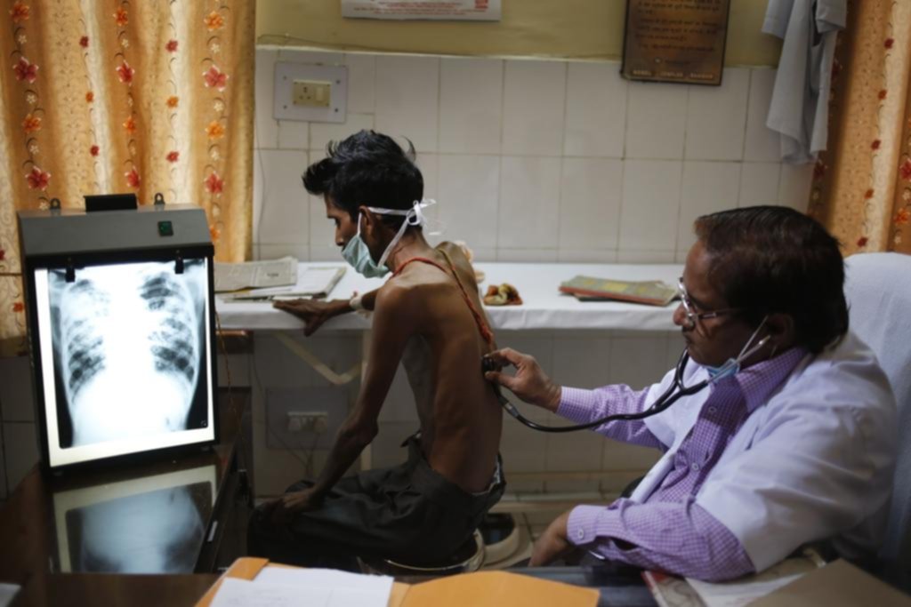 Tuberculosis, la principal causa de muerte entre personas con Sida