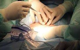 Chino de 72 "cumplió su sueño" al cambiar de sexo con una operación