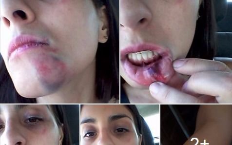Una chica recibió una brutal paliza por negarse a dar un beso