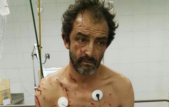 El vecino baleado en Los Hornos sigue grave y su familia reclama seguridad