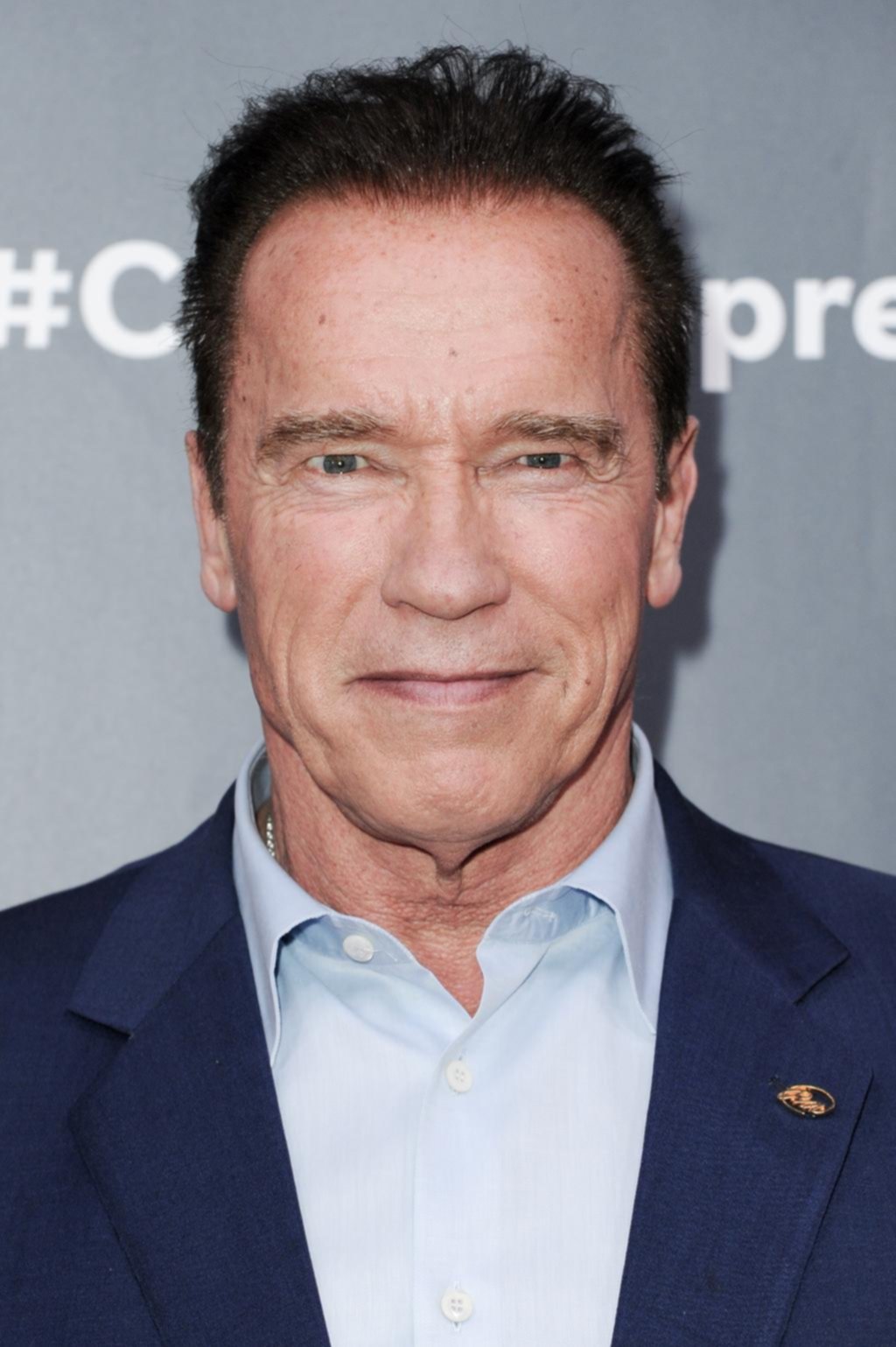 Arnold Schwarzenegger se recupera de una operación de emergencia
