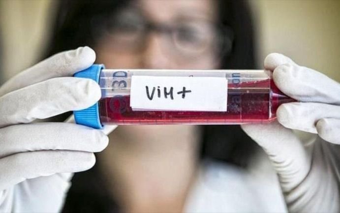 Lograron quitar el virus del VIH en un paciente por segunda vez en la historia