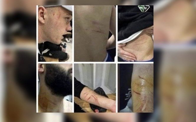 Los alfileres, "un poroto": futbolista salió a jugar armado e hirió a varios rivales