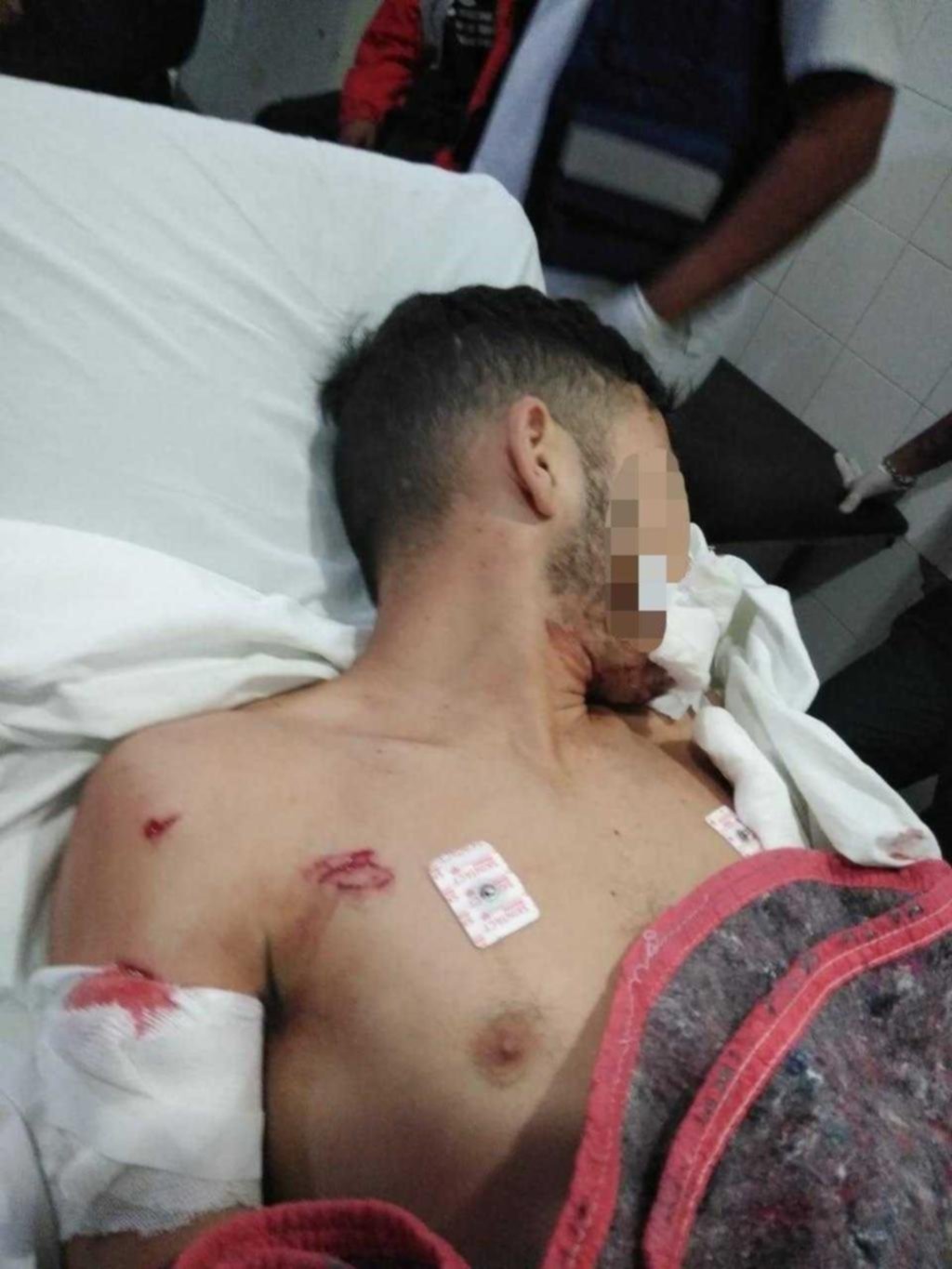 Preso se fugó del hospital por guardias “dormilones”
