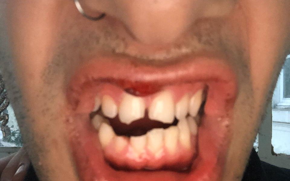 Joven platense denuncia que lo atacaron a golpes e insultos en un boliche LGBT de Capital 
