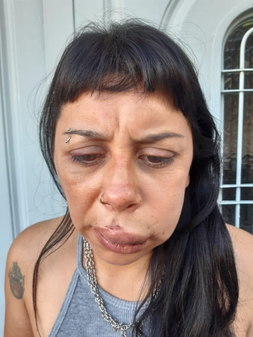 Golpeó de forma salvaje a su pareja y se fue a tomar el colectivo: lo detuvieron