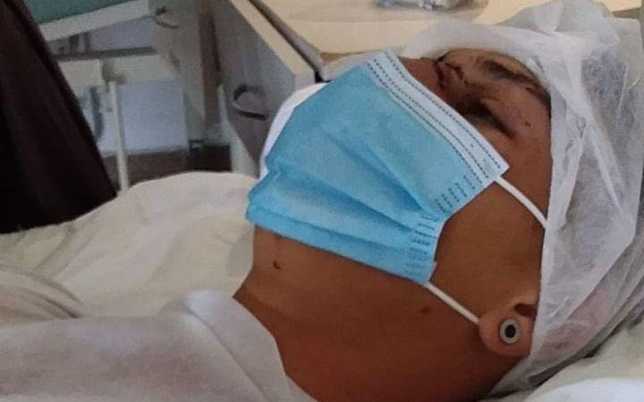 Un joven quintero se peleó con tres compañeros de trabajo y sufrió graves heridas en un ojo