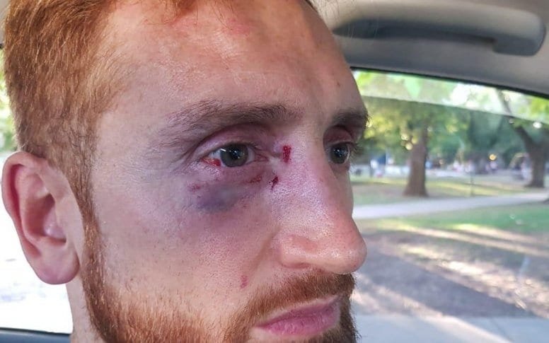 Otra vez la violencia en el deporte argentino: jugador de básquet golpeado por hinchas