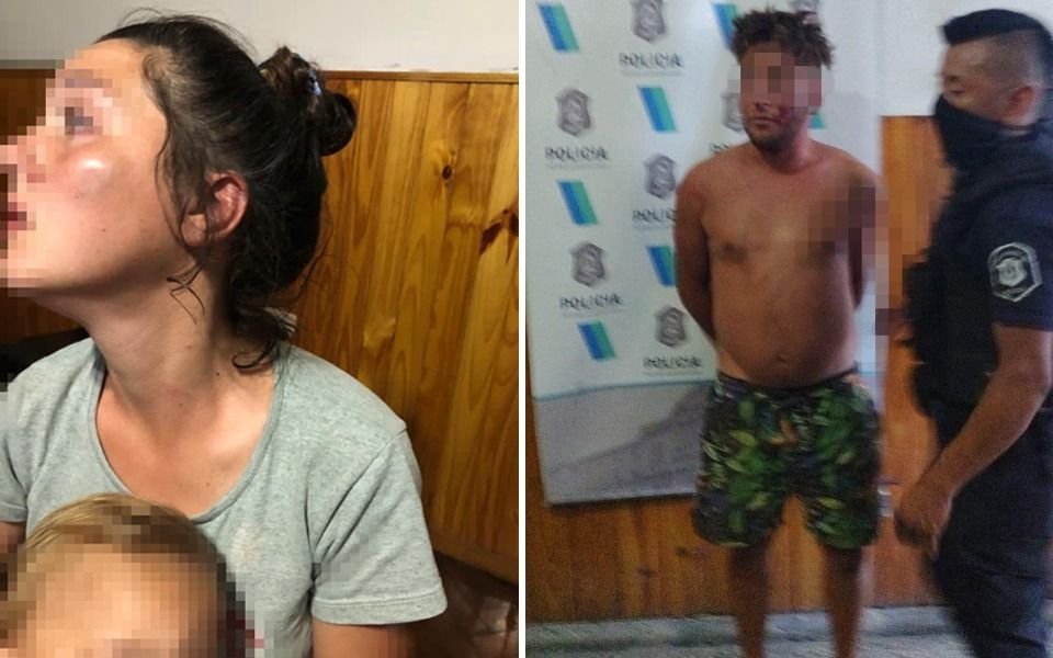 Los Hornos: le desfiguró a golpes la cara a su pareja