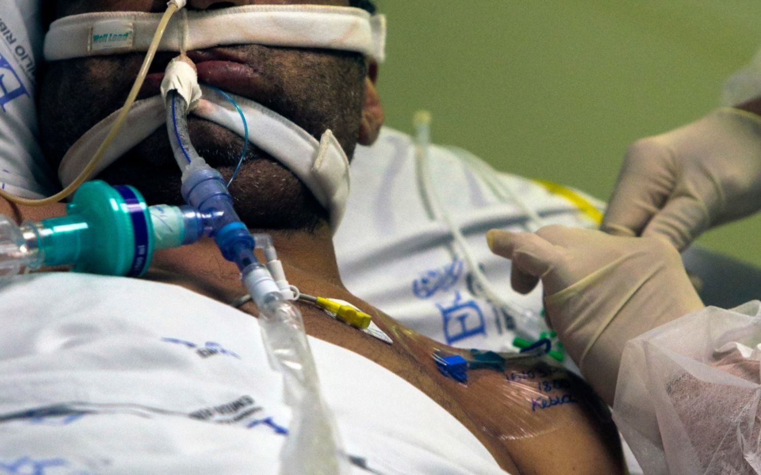 Brasil admite el "peor colapso sanitario y hospitalario de su historia"