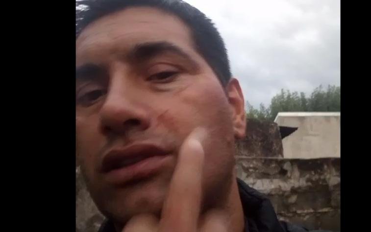 Motochorros lo atacaron a botellazos para quitarle el bolso y el celular en 13 y 90