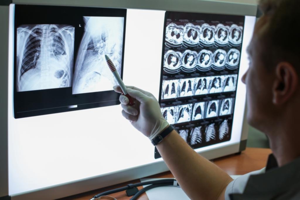Por la pandemia se detectan más casos de tuberculosis