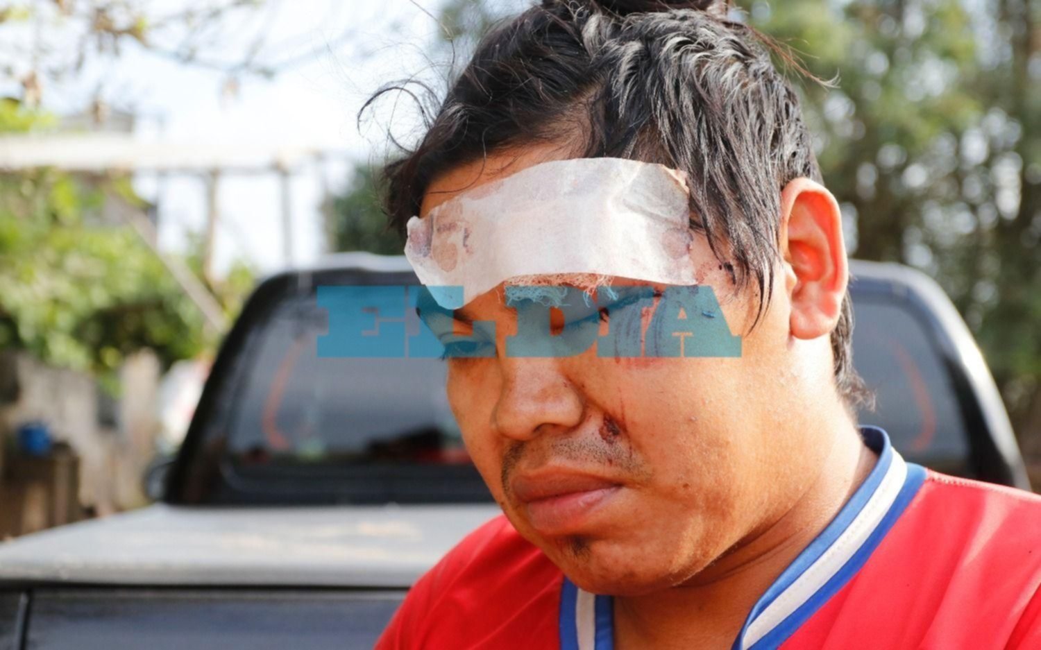 Otro salvaje robo a quinteros en La Plata: ladrillazos en la cabeza