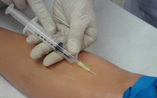 COVID: La UNLP se suma a la medición de anticuerpos en pacientes vacunados