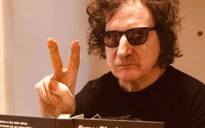 "Pronóstico reservado": cómo sigue la salud de Charly García tras el accidente doméstico