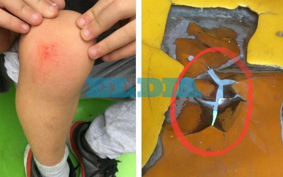 Queja por juegos rotos en el Parque Saavedra: un nene se lanzó de un tobogán y sufrió un corte de 3 cm