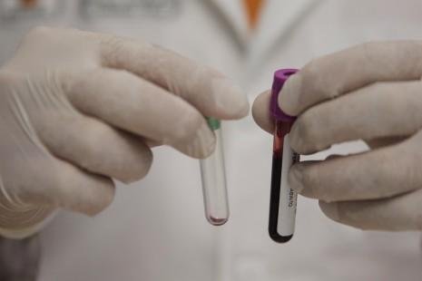 Microplásticos: hallan rastros en sangre humana