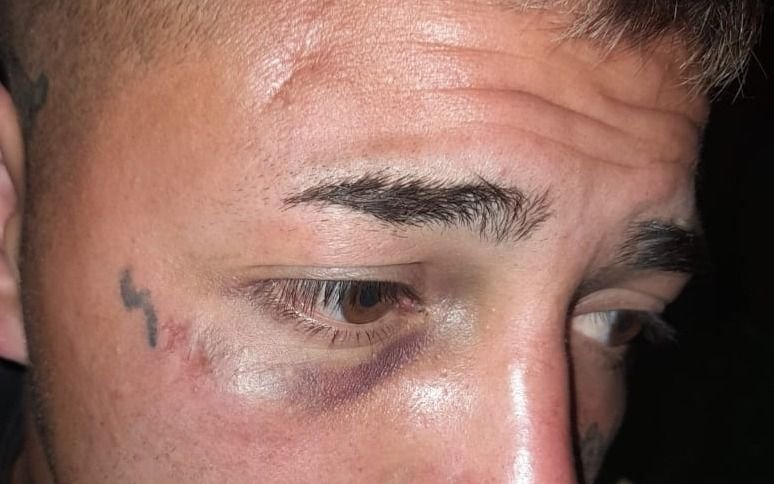 Una joven de La Plata le dio una paliza a su ex novio y amenazó con acuchillarlo