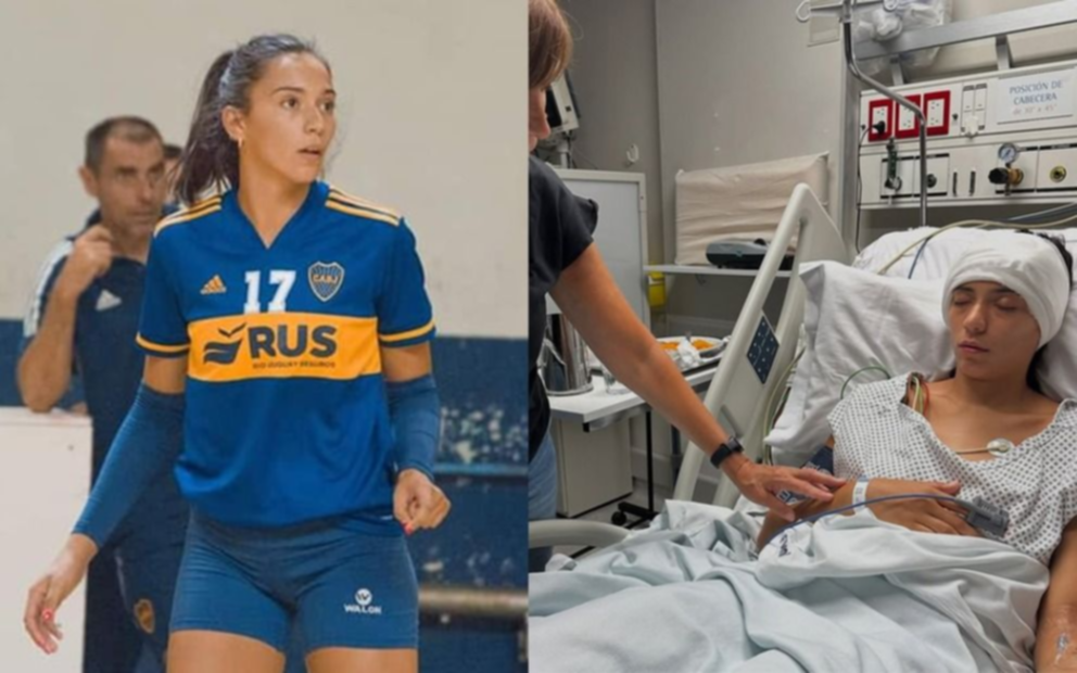 Chuchi Corbalán, de estrella del vóley platense a parar por malformación en el cerebro: "Nunca fui consciente de lo que era que me abrieran la cabeza"