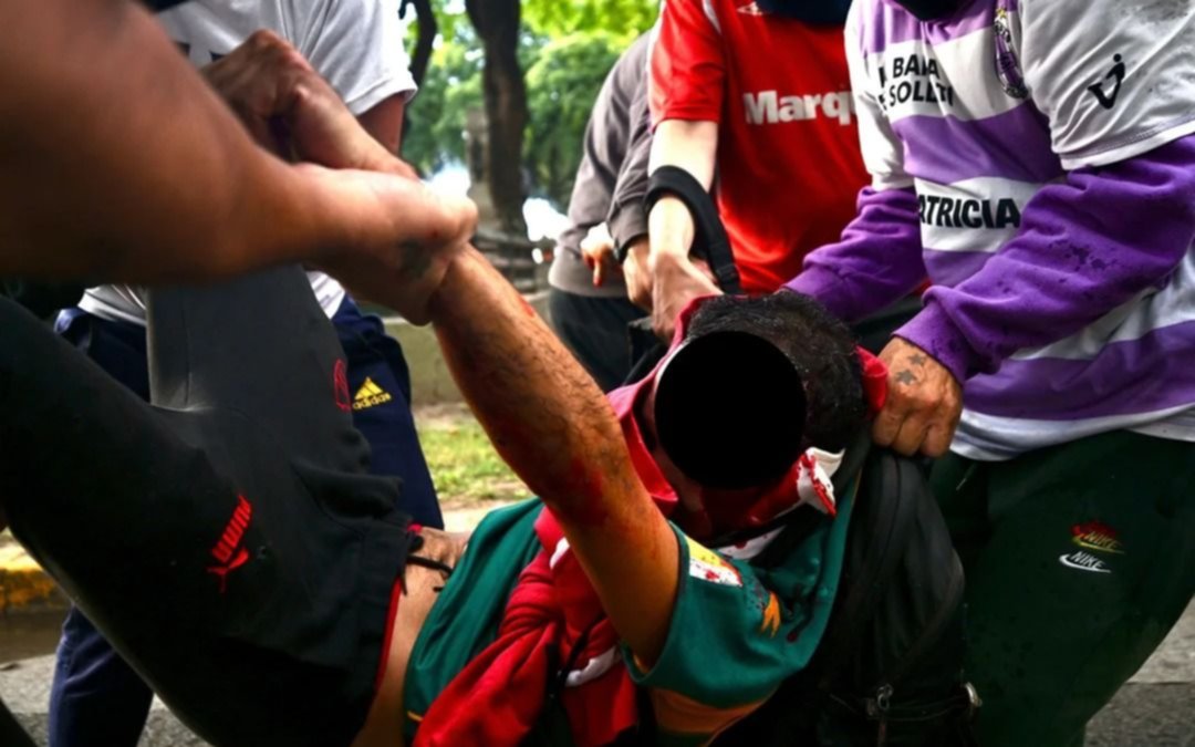 Parte médico de Pablo Grillo, el fotógrafo atacado por policías en la marcha de los jubilados