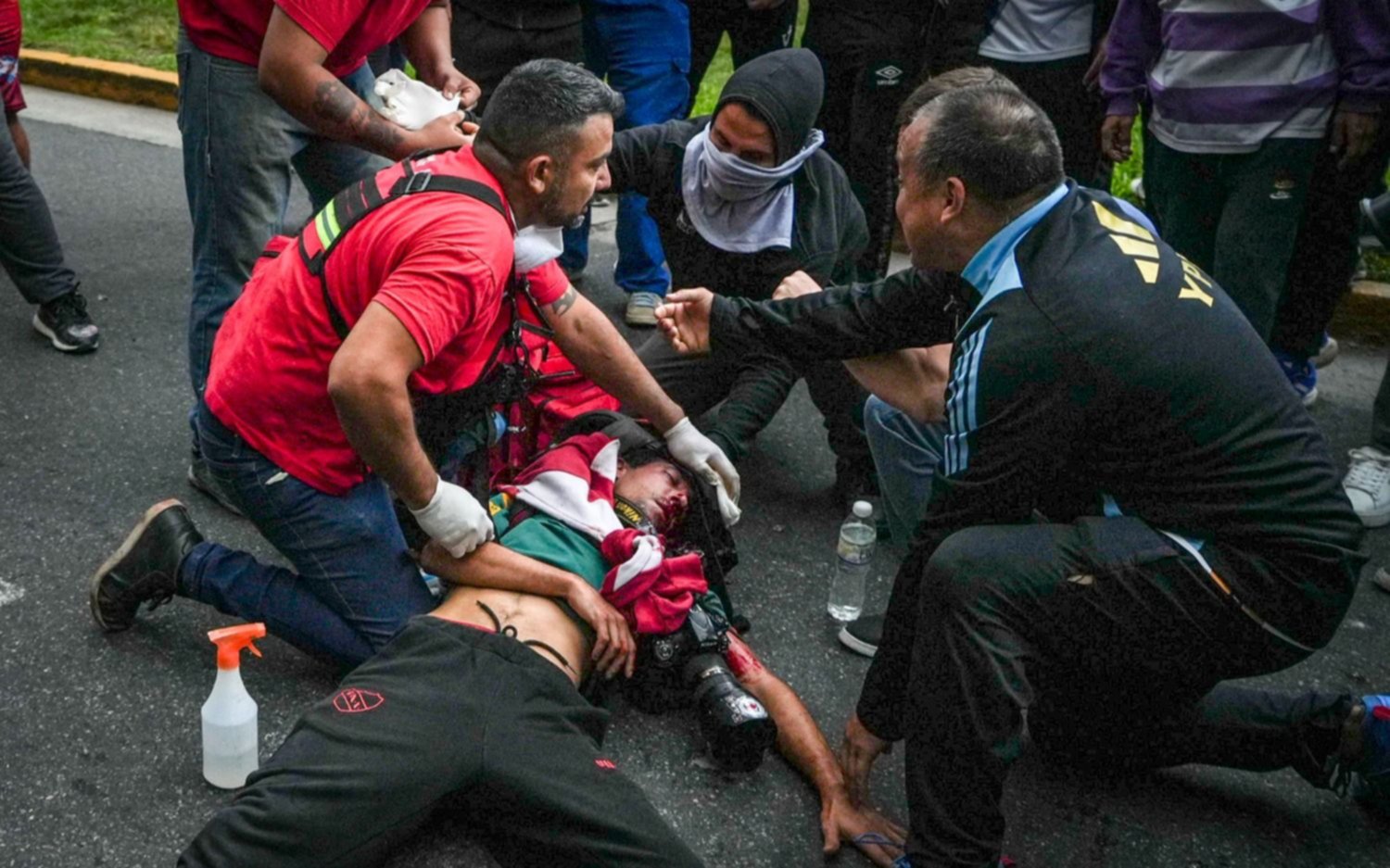 Marcha de jubilados: el Gobierno habló de "golpe de Estado" por los incidentes y dijo que lo del fotógrafo fue un "accidente imprevisto"