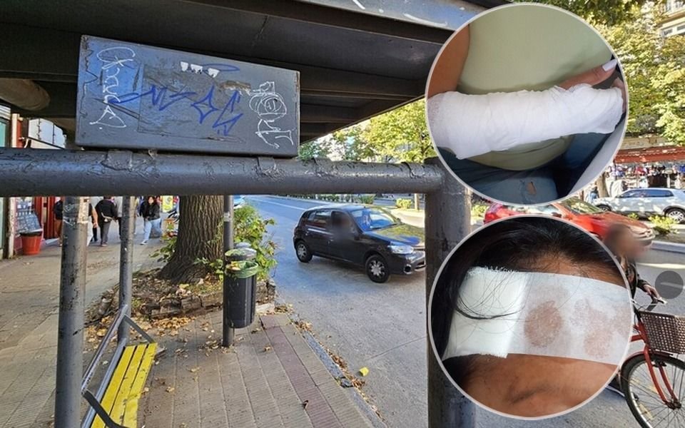 La Plata: le abrieron la cabeza y le fracturaron un brazo a una mujer cuando esperaba el micro