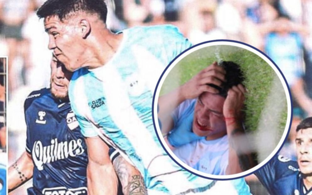 "Le volaron la dentadura": la dolorosa lesión que sufrió un ex Gimnasia
