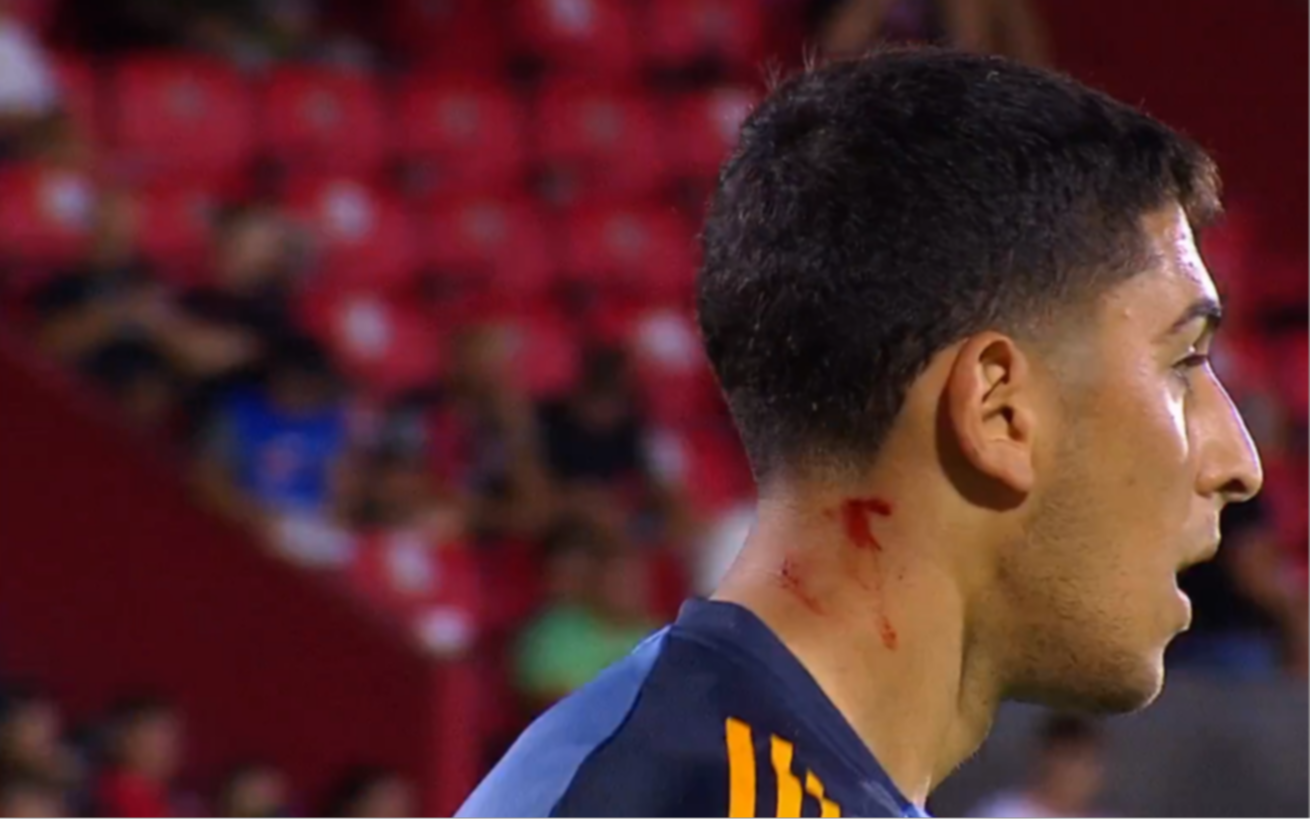 Boca vs Newell's: Brey y Marchesín fueron agredidos en la previa del partido con vidrios y latas