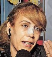 Alejandra Rubio dio detalles de la brutal golpiza de su ex marido