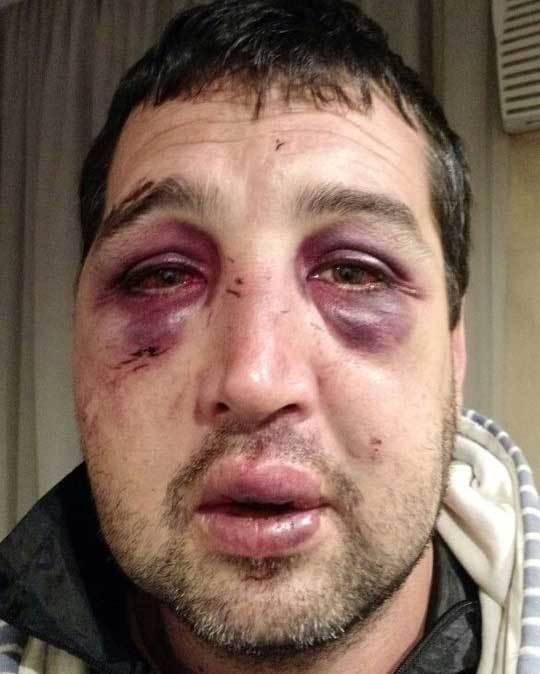 Presentarán una denuncia penal por brutal ataque en un boliche