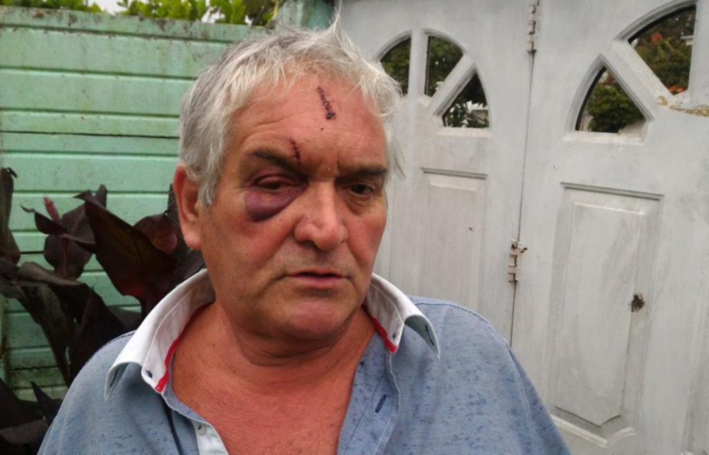 Recibió el alta el hombre golpeado por delincuentes