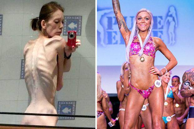 Venció la anorexia y se coronó como campeona de fisiculturismo