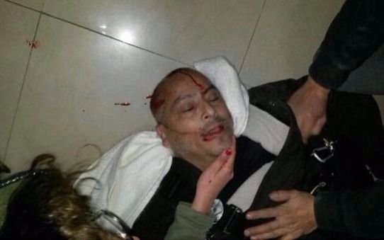 Habló el fotógrafo herido en Santa Cruz "no había banderas políticas"