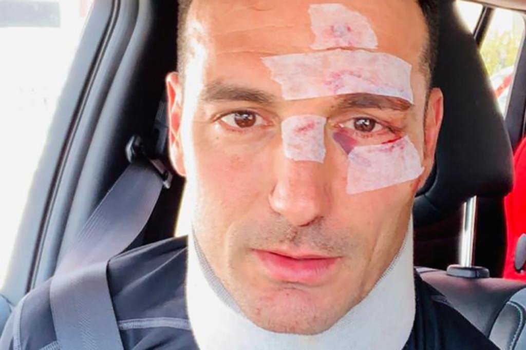 Scaloni, un accidente vial sin consecuencias graves y más cuestionamientos en la AFA