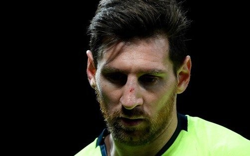 Messi, sin lesión en el rostro