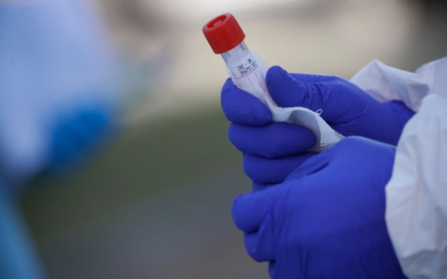Murió una mujer en el Conurbano y son 40 las víctimas fatales por coronavirus en el país