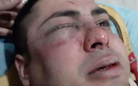 Cuatro detenidos por golpear y robarle el arma a dos policías tras violar la cuarentena