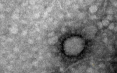 Difunden la primera foto del virus SARS-CoV-2 del COVID-19 tomada en Argentina