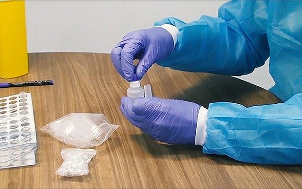 Producen un reactivo para acelerar y simplificar test moleculares para detectar coronavirus